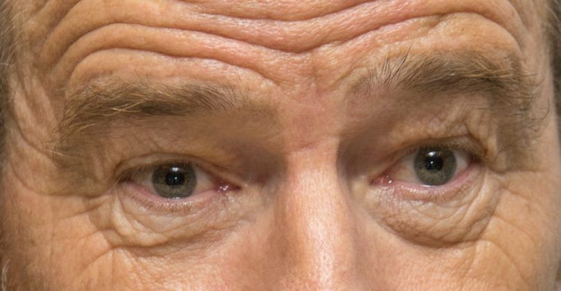 Can You Identify These Celebrity Eyes? | MagiQuiz